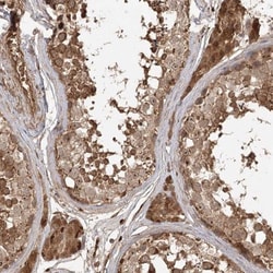 ARL13A Antibody, Novus Biologicals 0.1mL; Unlabeled:Antibodies, Polyclonal